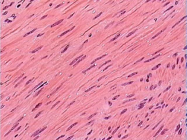 Smooth Muscle slide